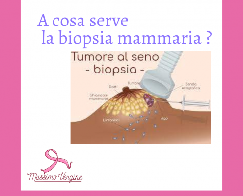 Biopsia mammaria- Prof. Massimo Vergine
